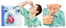 코피의 올바른 치료법