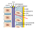 요추천자부위