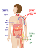 암일반-발생부위-암발생부위