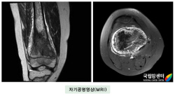 자기공명영상(MRI)