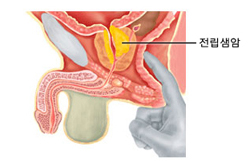 직장수지검사