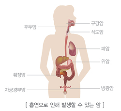 암예방지침서_위험요인별_금연