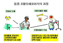 동종 조혈모세포이식의 과정