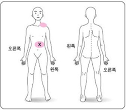 통증의 부위표시 예
