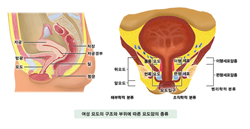 여성 요도의 구조와 부위에 따른 요도암의 종류