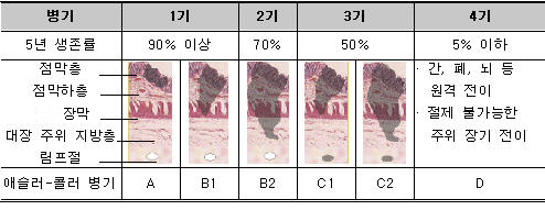 대장암의 병기별 생존율