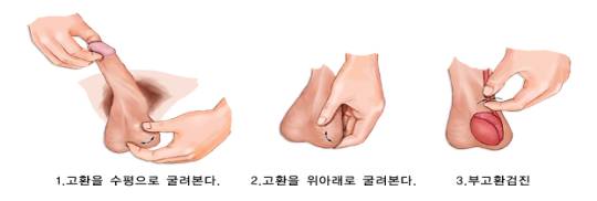 고환 자가검진 방법