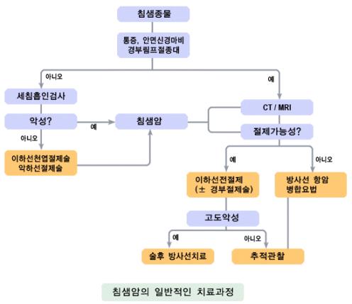 침샘암의 일반적인 치료과정
