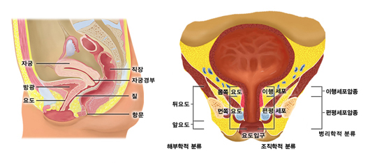 여성 요도의 구조와 부위에 따른 요도암의 종류