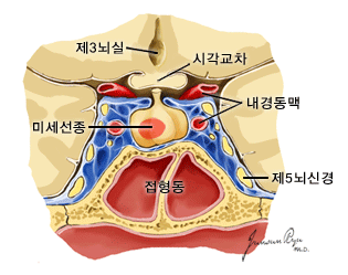 뇌하수체의 해부학적 구조, 관상면