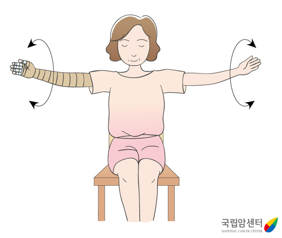 림프부종_팔 돌리기