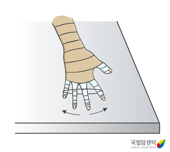 림프부종_손 운동2