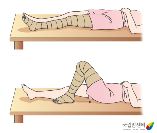 림프부종_다리 끌어 올리기
