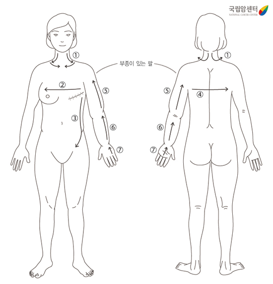 팔 도수 림프 배출법