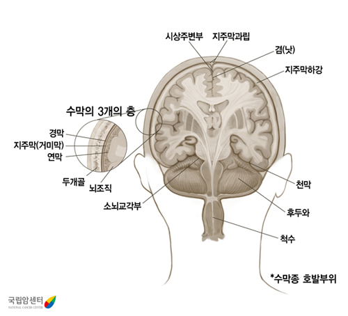 수막