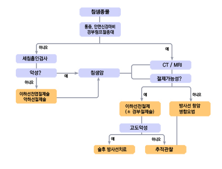 침샘암의 일반적인 치료과정