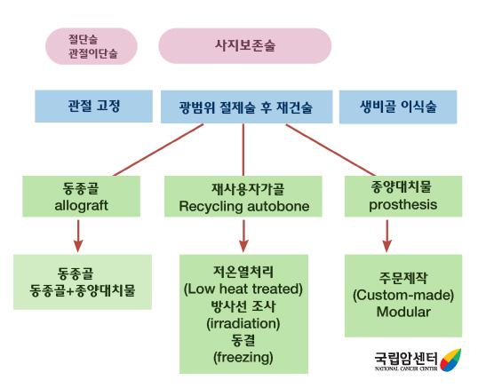 육종의 수술적 치료