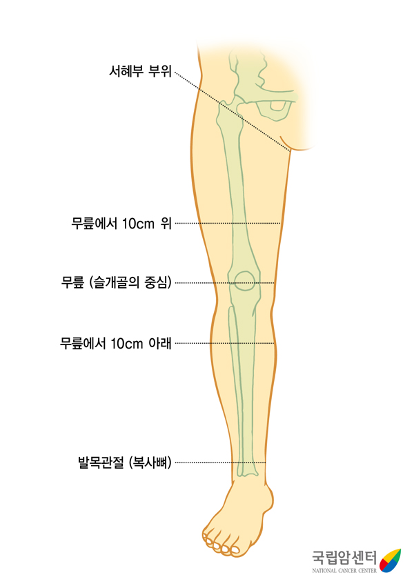 다리 둘레 측정부위