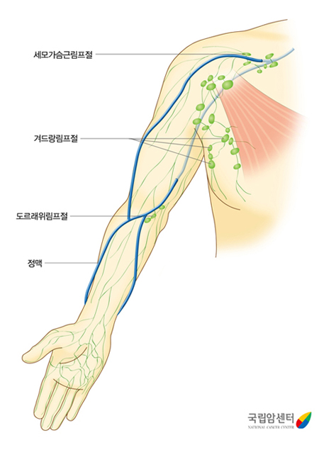 팔 림프계 -  팔 림프계는 어깨쪽 작은 콩모양의 세모가슴근림프절을 시작으로 겨드랑림프절, 팔이 접히는 부위인 도르래위림프절이 주로 분포되어 있으며, 그 주위로 림프관들이 손까지 그물모양으로 연결되어 있습니다. 