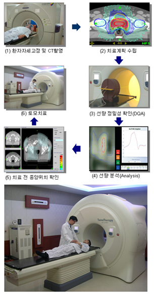 토모 치료기 - 1)환자자세 고정 및 ct촬영 2) 치료계획수립 3) 선량정밀성 확인 4) 선량분석 5) 치료 전 종양위치 확인 6) 토모치료 