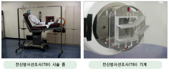 전신방사선조사(TBI) 시술 중인 사진과 전신방사선조사(TBL)기계 사진