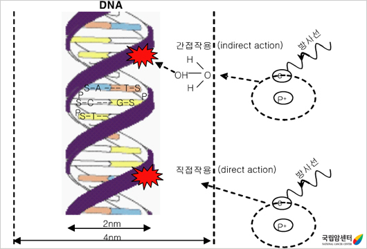 방사선 치료의 예 -  방사선을 세포에 조사하면 방사선이 세포의 DNA와 세포막에 직•간접적으로 작용하여 암세포를 죽이는 것으로 알려져 있습니다. 