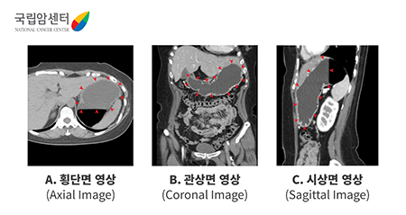 [국립암센터] A. 횡단면 영상(Axial Image) / B. 관상면 영상(Coronal Image) / C. 시상면 영상(Sagittal Image)