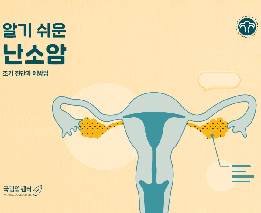 알기 쉬운 난소암 조기진단과 예방법 (국립암센터 NATIONAL CANCER CENTER)