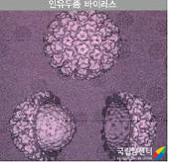 사람유두종바이러스