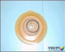 장루주머니 교환 방법(3)