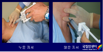 갑상선암의 미세침흡인세포검사(1)