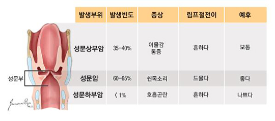 발생부위, 발생빈도, 증상, 림프절전이, 예후 / 성문상부암 35-40%, 이물감통증, 흔하다, 보통, 성문암, 60-65% 쉰목소리, 드물다, 좋다, 성문하부암 1%미만, 호흡곤란, 흔하다, 나쁘다