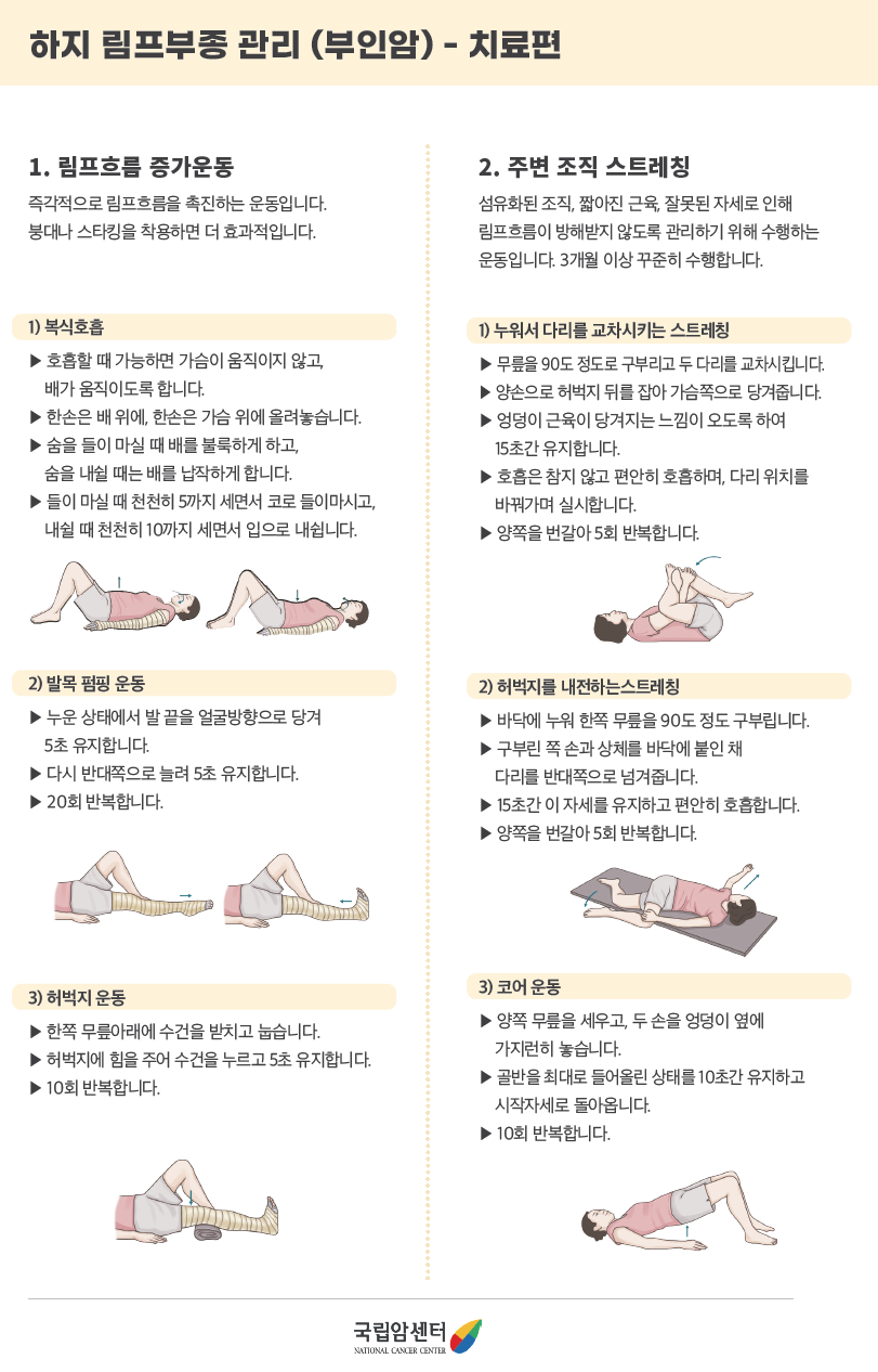 하지 림프부종 관리(부인암) - 치료편 1. 림프흐름 증가운동 즉각적으로 림프흐름을 촉진하는 운동입니다. 붕대나 스타킹을 착용하면 더 효과적입니다.  1) 복식호흡 ▶ 호흡할 때 가능하면 가슴이 움직이지 않고 배가 움직이도록 합니다. ▶ 한손은 배 위에, 한손은 가슴 위에 올려놓습니다. ▶ 숨을 들이마실 때 배를 불룩하게 하고, 숨을 내쉴 때는 배를 납작하게 합니다. ▶ 들이 마실 때 천천히 5까지 세면서 코로 들이마시고, 내쉴 때 천천히 10까지 세면서 입으로 내쉽니다.  2) 발목 펌핑 운동 ▶ 누운 상태에서 발끝을 얼굴방향으로 당겨 5초 유지합니다. ▶ 다시 반대쪽으로 늘려 5초 유지합니다. ▶ 20회 반복합니다.  3) 허벅지 운동 ▶ 한쪽 무릎아래에 수건을 받치고 눕습니다. ▶ 허벅지에 힘을 주어 수건을 누르고 5초 유지합니다.  ▶ 10회 반복합니다.   2. 주변 조직 스트레칭 섬유화된 조직, 짧아진 근육, 잘못된 자세로 인해 림프흐름이 방해받지 않도록 관리하기 위해 수행하는 운동입니다. 3개월 이상 꾸준히 수행합니다.  1) 누워서 다리를 교차시키는 스트레칭 ▶ 무릎을 90도 정도로 구부리고 두 다리를 교차시킵니다. ▶ 양손으로 허벅지 뒤를 잡아 가슴쪽으로 당겨줍니다.  ▶ 엉덩이 근육이 당겨지는 느낌이 오도록 하여 15초간 유지합니다. ▶ 호흡은 참지 않고 편안히 호흡하며, 다리 위치를 바꿔가며 실시합니다. ▶ 양쪽을 번갈아 5회 반복합니다.  2) 허벅지를 내전하는스트레칭 ▶ 바닥에 누워 한쪽 무릎을 90도 정도 구부립니다. ▶ 구부린 쪽 손과 상체를 바닥에 붙인 채 다리를 반대쪽으로 넘겨줍니다. ▶ 15초간 이 자세를 유지하고 편안히 호흡합니다.  ▶ 양쪽을 번갈아 5회 반복합니다.  3) 코어 운동 ▶ 양쪽 무릎을 세우고, 두 손을 엉덩이 옆에 가지런히 놓습니다. ▶ 골반을 최대로 들어올린 상태를 10초간 유지하고 시작자세로 돌아옵니다. ▶ 10회 반복합니다.