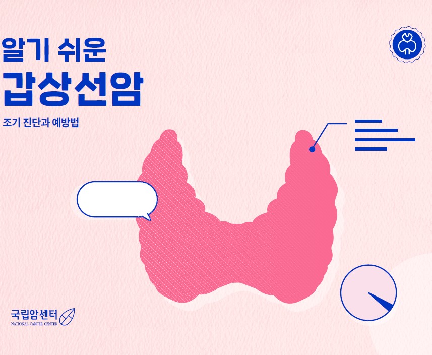 알기 쉬운 갑상선암 조기진단과 예방법
