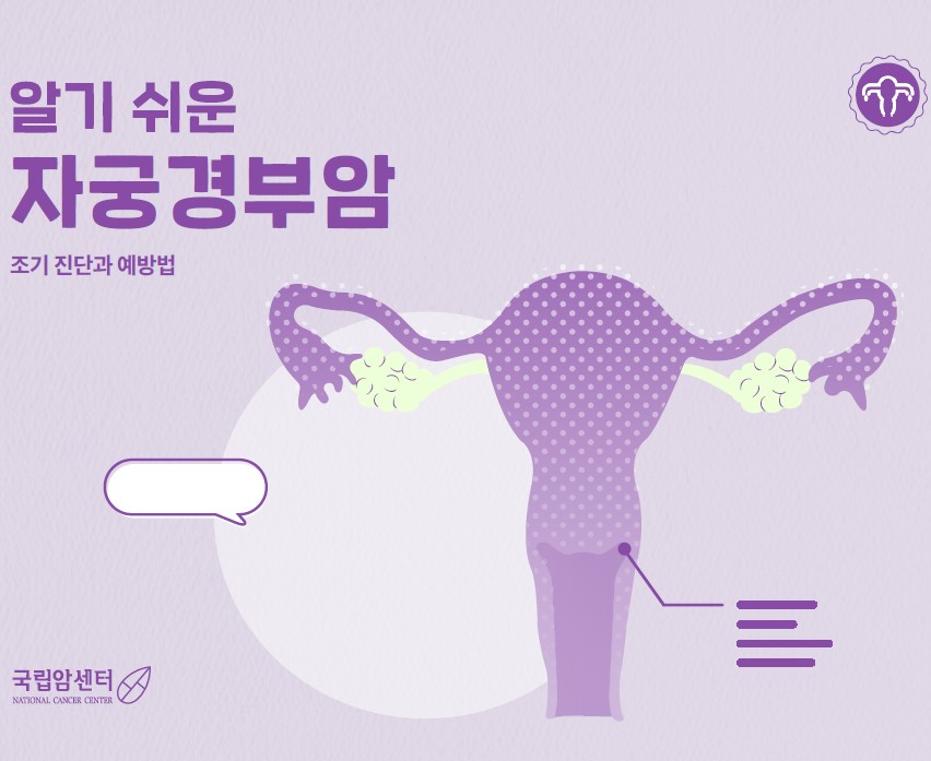 알기 쉬운 자궁경부암 조기진단과 예방법